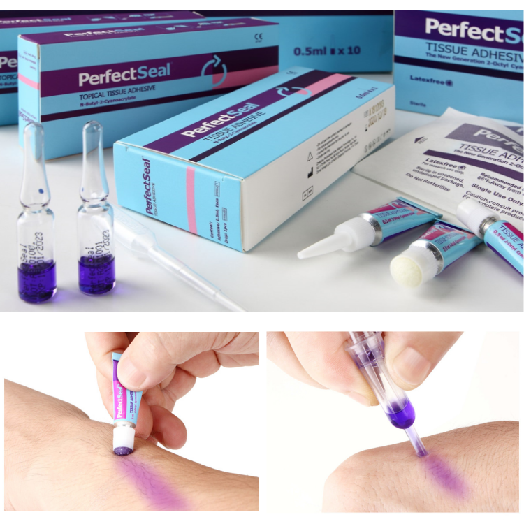 Perfectseal Medical Super Glue Wound Glue Cyanoacrylate Skin