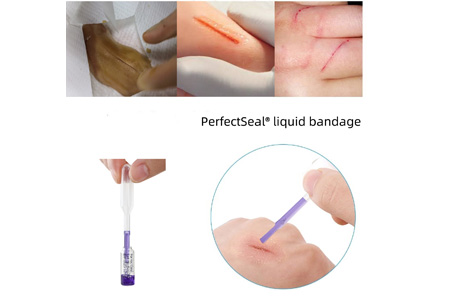 Difference Between Surgical Glue and Liquid Stitches in Wound